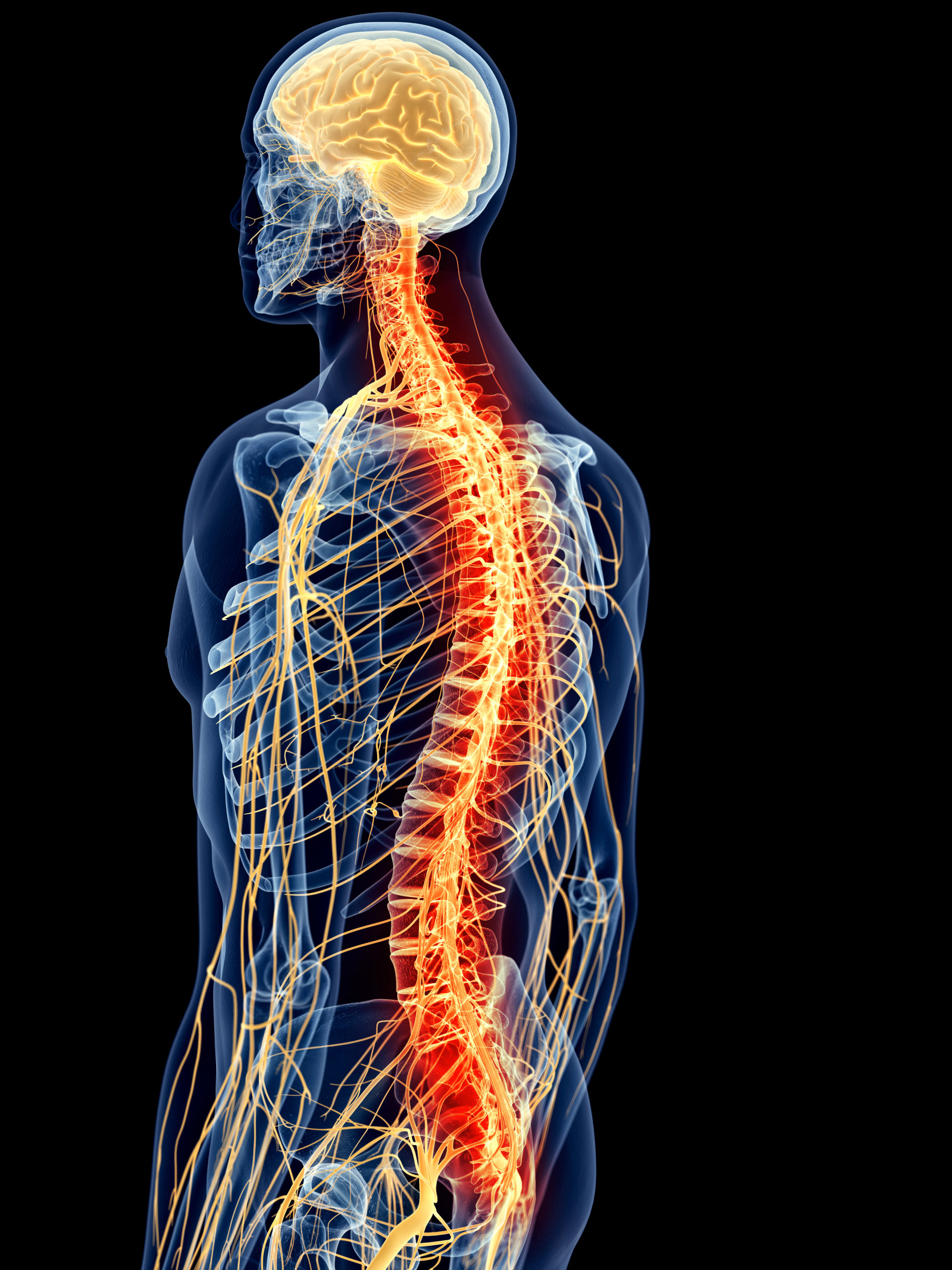 Entzündung der Wirbelsäule (Spinale Infektion) - neurospine.at